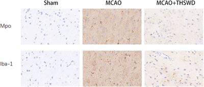 Taohong Siwu Decoction Regulates Cell Necrosis and Neuroinflammation in the Rat Middle Cerebral Artery Occlusion Model